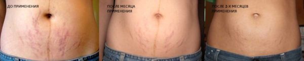 Изменения кожи после применения средства с мумиё